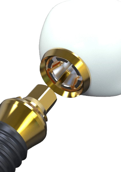 Click-Fit Abutment